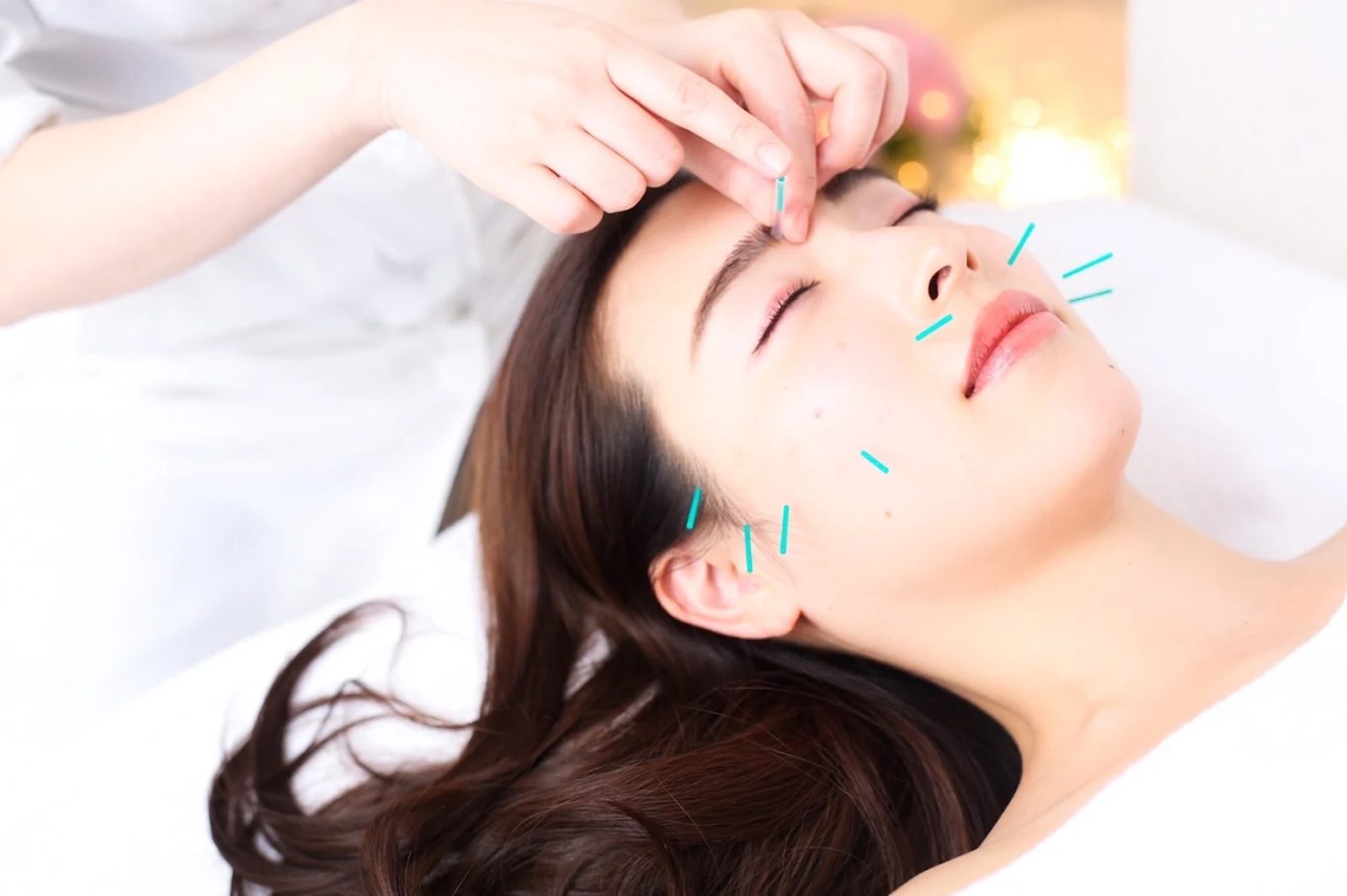 Beauty acupuncture session