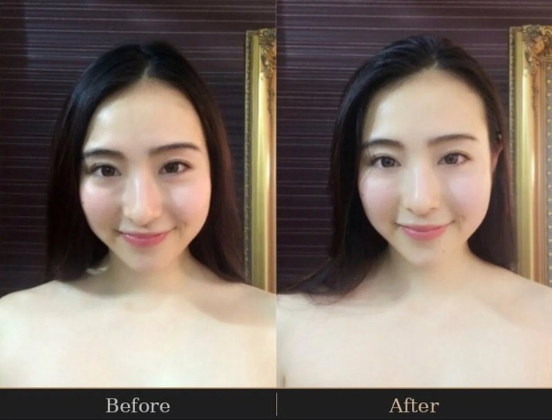 Before and after - brightened skin and sharper contour